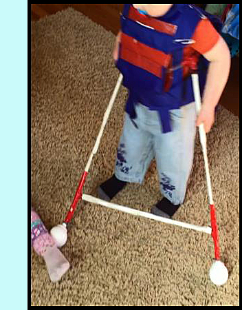 photo shows a small toddler wearing a belt that has two canes attached -- the canes are connected with a bar along the front.